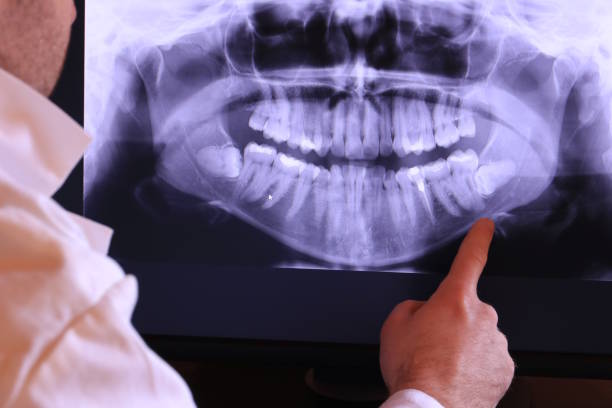 Best Emergency Dentist for Lost Fillings or Crowns in Gila Bend, AZ